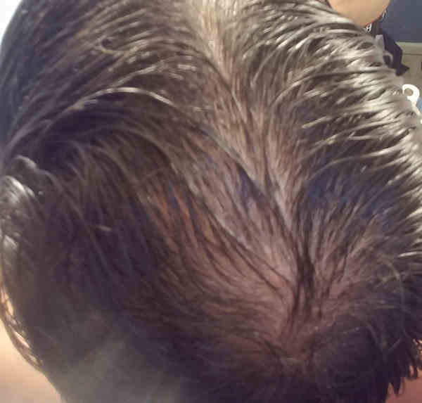 When my hair is wet, the bald spot is more obvious
